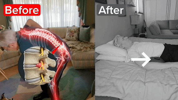 BackReset relief transformation